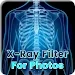 XRAY照片濾鏡app(Xray Filter for Photos)